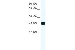 Western Blotting (WB) image for anti-Tumor Necrosis Factor (Ligand) Superfamily, Member 12 (TNFSF12) (N-Term) antibody (ABIN2792305)