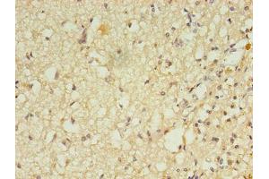 Immunohistochemistry of paraffin-embedded human brain tissue using ABIN7167621 at dilution of 1:100 (RGS7 Antikörper  (AA 1-487))