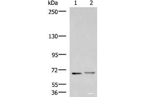 Western blot analysis of Mouse brain tissue and Human cerebrum tissue lysates using EXD2 Polyclonal Antibody at dilution of 1:700 (EXD2 Antikörper)