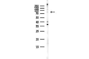 Western blot analysis of lysates from HepG2 cells(heat-shock,45 min treatment), using LRRC41 Antibody at 1/1000 dilution.