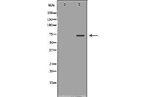 BIRC2 Antikörper  (C-Term)