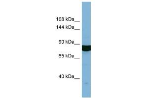 Host:  Rabbit  Target Name:  HACE1  Sample Type:  OVCAR-3 Whole cell lysates  Antibody Dilution:  1. (HACE1 Antikörper  (N-Term))