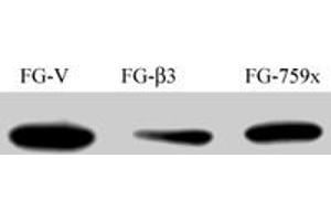 FG Pancreatic Carcinoma Cell Lines stably expressing vector along (FG-V) the beta3 integrin subunit (FG-beta3) or a beta3 truncation mutant (FG-759x) . (Src Antikörper)
