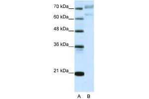 WB Suggested Anti-AATF Antibody Titration:  5. (AATF Antikörper  (N-Term))