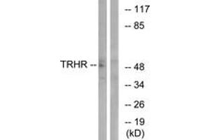 Western blot analysis of extracts from COS7 cells, using TRHR Antibody.