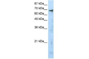 WB Suggested Anti-HTATIP Antibody Titration:  0. (KAT5 Antikörper  (N-Term))