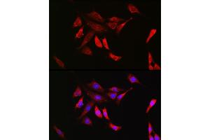 Immunofluorescence analysis of NIH/3T3 cells using SHP2 Rabbit mAb (ABIN7269704) at dilution of 1:100 (40x lens). (PTPN11 Antikörper)