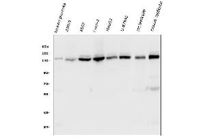 Western blot analysis of HAUSP/USP7 using anti-HAUSP/USP7 antibody (ABIN6719603). (USP7 Antikörper  (AA 258-483))
