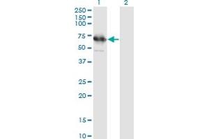 Western Blot analysis of TSKS expression in transfected 293T cell line by TSKS monoclonal antibody (M01), clone 2E9.