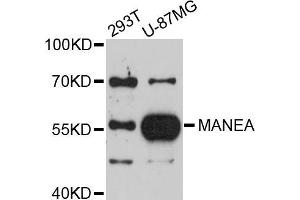 Western blot analysis of extracts of various cell lines, using MANEA antibody (ABIN5998166) at 1/1000 dilution. (MANEA Antikörper)