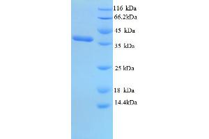 SDS-PAGE (SDS) image for Olfactory Marker Protein (OMP) (AA 27-349), (partial) protein (His tag) (ABIN4984038)
