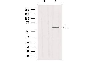 Western blot analysis of extracts from Hepg2, using MMP11 Antibody. (MMP11 Antikörper  (N-Term))