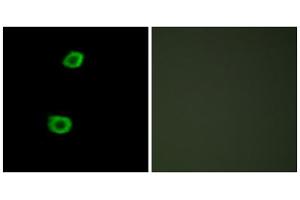 Immunofluorescence analysis of HepG2 cells, using LMTK2 antibody. (LMTK2 Antikörper  (Internal Region))