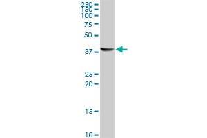 Western Blotting (WB) image for anti-Acetyl-CoA Acyltransferase 1 (ACAA1) (AA 217-316) antibody (ABIN599345) (ACAA1 Antikörper  (AA 217-316))