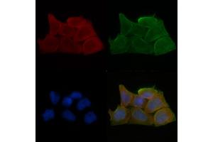 ABIN6259712 and ABIN6279061 staining Hela cells(30 min of UV treatment) by IF/ICC.