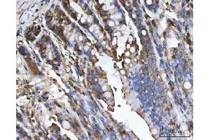 IHC analysis of CA1 using anti-CA1 antibody (ABIN3043766). (CA1 Antikörper  (AA 9-261))