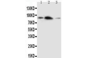 Anti-APLP2 antibody,  Western blotting Lane 1: Rat Brain Tissue Lysate Lane 2: Rat Heart Tissue Lysate Lane 3: SMMC Cell Lysate