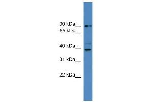WB Suggested Anti-ZRANB1 Antibody Titration: 0. (ZRANB1 Antikörper  (C-Term))