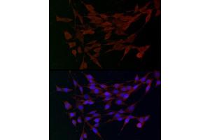 Immunofluorescence (IF) image for anti-ADAM Metallopeptidase with thrombospondin Type 1 Motif, 5 (ADAMTS5) (AA 731-930) antibody (ABIN3016806)