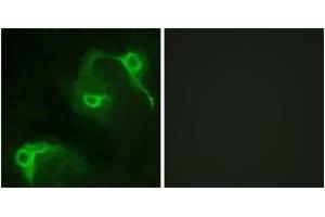 Immunofluorescence (IF) image for anti-Vav 2 Guanine Nucleotide Exchange Factor (VAV2) (AA 108-157) antibody (ABIN2888936) (VAV2 Antikörper  (AA 108-157))