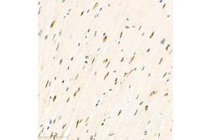 Immunohistochemistry analysis of paraffin embedded mouse heart using KCNIP3 (ABIN7073771) at dilution of 1: 2000 (DREAM Antikörper)