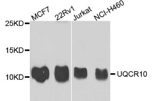 Western blot analysis of extracts of various cell lines, using UQCR10 antibody. (UQCR10 Antikörper)