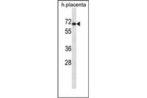 Western blot analysis of LZTS1 Antibody (N-term) in human placenta tissue lysates (35ug/lane). (LZTS1 Antikörper  (N-Term))