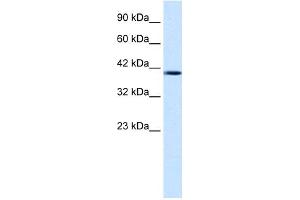 WB Suggested Anti-NUCB2 Antibody Titration: 1. (NUCB2 Antikörper  (Middle Region))