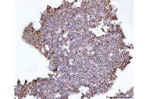 IHC analysis of SNAP23 using anti-SNAP23 antibody (ABIN7599089). (SNAP23 Antikörper  (AA 1-211))