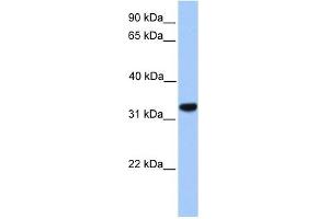 CACNG4 antibody used at 1 ug/ml to detect target protein. (CACNG4 Antikörper  (N-Term))