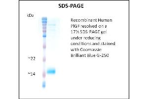 SDS-PAGE (SDS) image for Placenta Growth Factor (PGF) (Active) protein (ABIN5509580) (PLGF Protein)