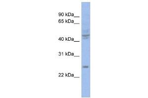WB Suggested Anti-PROP1  Antibody Titration: 0. (PROP1 Antikörper  (Middle Region))