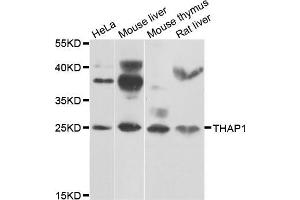 Western blot analysis of extracts of various cell lines, using THAP1 antibody (ABIN5975558) at 1/1000 dilution. (THAP1 Antikörper)