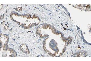 ABIN6268850 at 1/100 staining Human prostate tissue by IHC-P. (DCT Antikörper  (N-Term))
