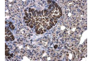 IHC-P Image Calpain 1 antibody [N3C2], Internal detects Calpain 1 protein at cytoplasm on mouse lung by immunohistochemical analysis. (CAPN1 Antikörper)