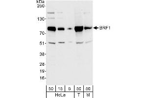 Western Blotting (WB) image for anti-BRF1, RNA polymerase III transcription initiation factor subunit (BRF1) (AA 627-677) antibody (ABIN7454729)