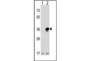 Western Blotting (WB) image for anti-Myelin Protein Zero (MPZ) (AA 193-223), (C-Term) antibody (ABIN453751)