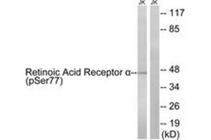 Western blot analysis of extracts from Jurkat cells treated with PMA 125ng/ml 30' and Jurkat cells treated with insulin 0. (Retinoic Acid Receptor alpha Antikörper  (pSer77))
