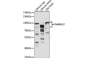 Western blot analysis of extracts of various cell lines, using TMPRSS7 antibody (ABIN7270949) at 1:1000 dilution. (TMPRSS7 Antikörper  (AA 478-717))