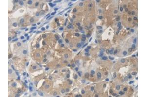 DAB staining on IHC-P; Samples: Human Stomach Tissue (SCARA5 Antikörper  (AA 118-495))