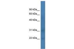 Image no. 1 for anti-TAF12 RNA Polymerase II, TATA Box Binding Protein (TBP)-Associated Factor, 20kDa (TAF12) (C-Term) antibody (ABIN6746030)