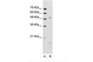 Image no. 1 for anti-Integrin, beta-Like 1 (With EGF-Like Repeat Domains) (ITGBL1) (N-Term) antibody (ABIN203507) (ITGBL1 Antikörper  (N-Term))