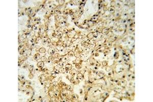 Immunohistochemistry (IHC) image for anti-HLA Class I Histocompatibility Antigen, alpha Chain G (HLAG) (AA 62-89) antibody (ABIN3031240)