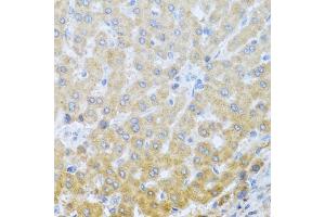 Immunohistochemistry of paraffin-embedded human liver using IL20 antibody (ABIN6128133, ABIN6142353, ABIN6142354 and ABIN6222322) at dilution of 1:100 (40x lens). (IL-20 Antikörper  (AA 25-176))