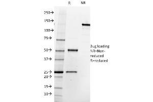 SDS-PAGE Analysis Purified FOLH1 (PSMA) Mouse Monoclonal Antibody (SPM500). (PSMA Antikörper  (AA 232-433))