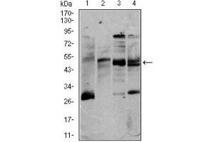 Western Blotting (WB) image for anti-CD5 (CD5) (AA 27-233) antibody (ABIN1845336) (CD5 Antikörper  (AA 27-233))