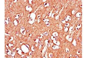 Immunohistochemistry of paraffin-embedded human brain tissue using ABIN7150398 at dilution of 1:100 (IGHMBP2 Antikörper  (AA 646-884))
