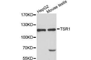 Western blot analysis of extracts of various cell lines, using TSR1 antibody (ABIN6293796) at 1:3000 dilution. (TSR1 Antikörper)