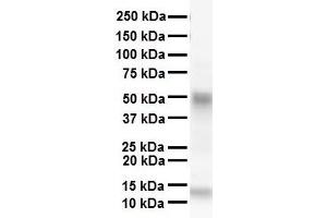WB Suggested Anti-SMAD6 antibody Titration: 1 ug/mL Sample Type: Human heart
