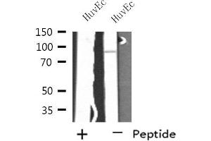 Western blot analysis of extracts from HuvEc cells, using SH3RF3 antibody. (SH3RF3 Antikörper  (C-Term))